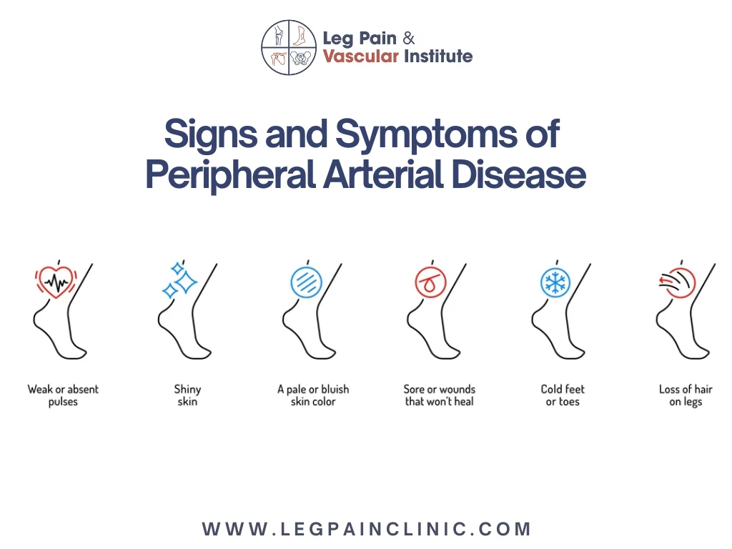 Understanding Signs and Symptoms of Peripheral Arterial Disease